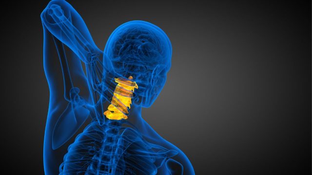 頚椎ヘルニアを放置するとどうなる？予防と治療のポイント。