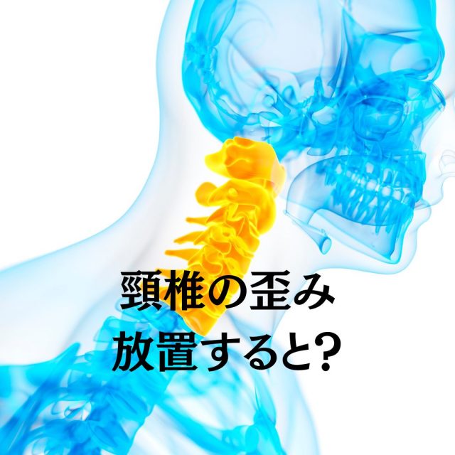 頸椎の歪みを放置するとどうなる？頭が傾いている人は要注意。